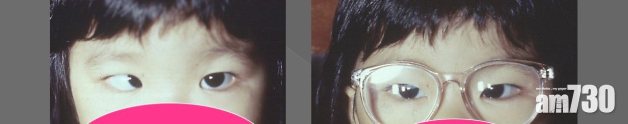 1621845027316474.jpg 斜視眼影響深遠 及早糾正救視力2.jpg