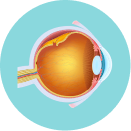 視網膜脫落及疾病